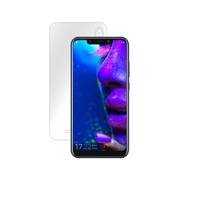 folie de protectie clasic smart protection allview soul x5 style spateprotectie completa spatesmart spraysmart squeegeeinstructiuni instalare si microfibra incluse imagen 59_0_
0