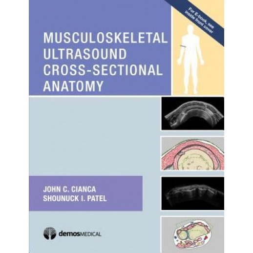 Musculoskeletal Ultrasound Cross Sectional Anatomy, John Cianca (Author)