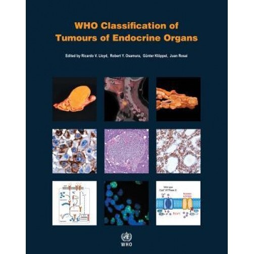 Who Classification of Tumours of Endocrine Organs, International Agency for Research on Can (Author)