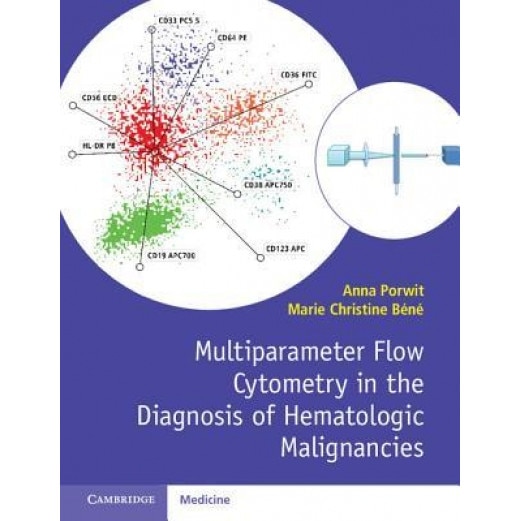 Multiparameter Flow Cytometry in the Diagnosis of Hematologic Malignancies, Anna Porwit (Editor)