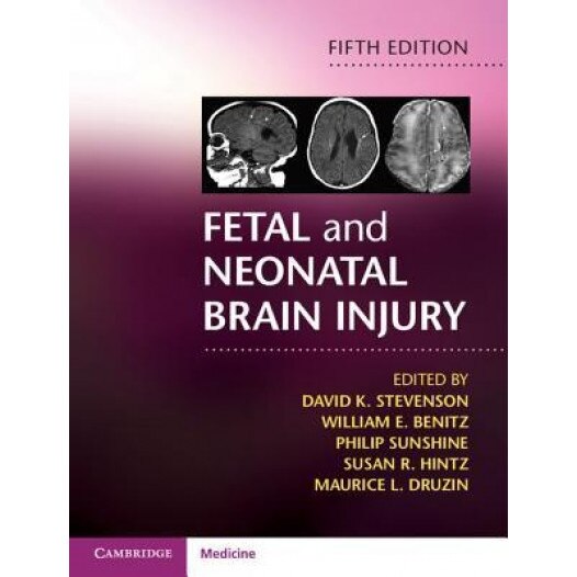 Fetal and Neonatal Brain Injury, David K. Stevenson (Editor)