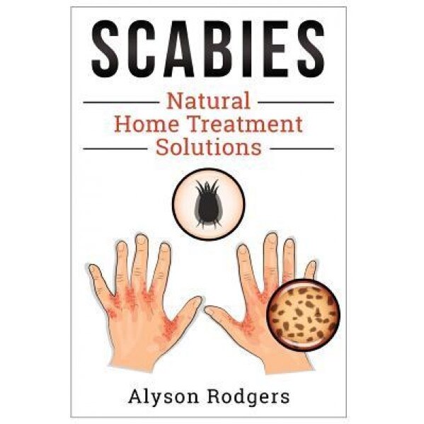 Scabies Natural Home Treatment Solution, Alyson Rodgers (Author)