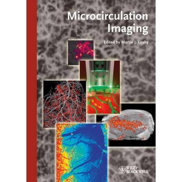 Microcirculation Imaging