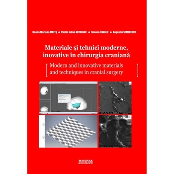 Materiale si tehnici moderne, inovative in chirurgia craniana, Ileana Mariana Mates, Vasile Iulian Antoniac, Simona Cavalu, Augustin Semenescu Materiale si tehnici moderne, inovative in chirurgia craniana, Ileana Mariana Mates, Vasile Iulian Antoniac, Simona Cavalu, Augustin Semenescu