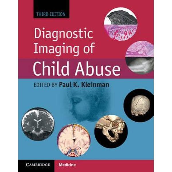 Diagnostic Imaging of Child Abuse