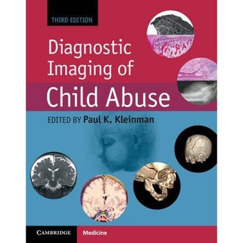 Diagnostic Imaging of Child Abuse Diagnostic Imaging of Child Abuse