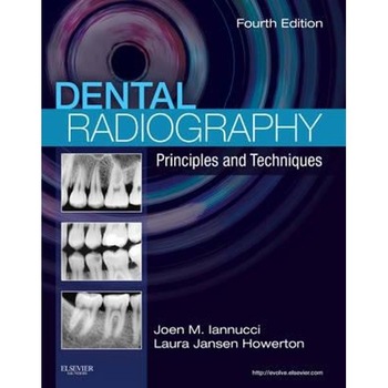 Dental Radiography Dental Radiography