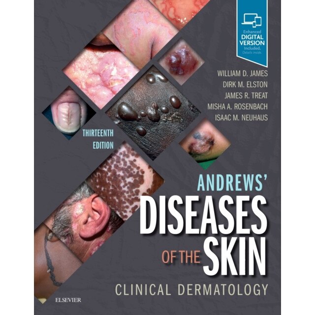 Andrews' Diseases of the Skin de William D. James