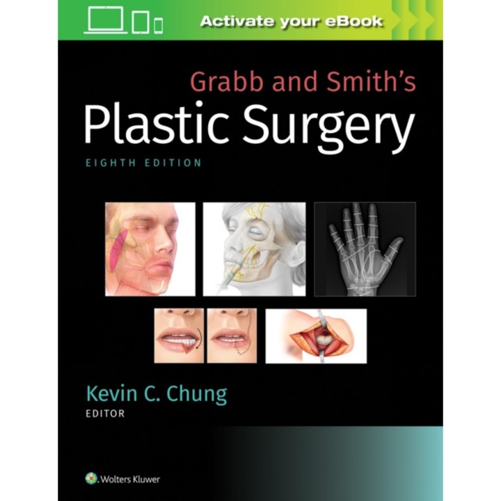 Grabb and Smith's Plastic Surgery de Kevin C Chung MD, MS