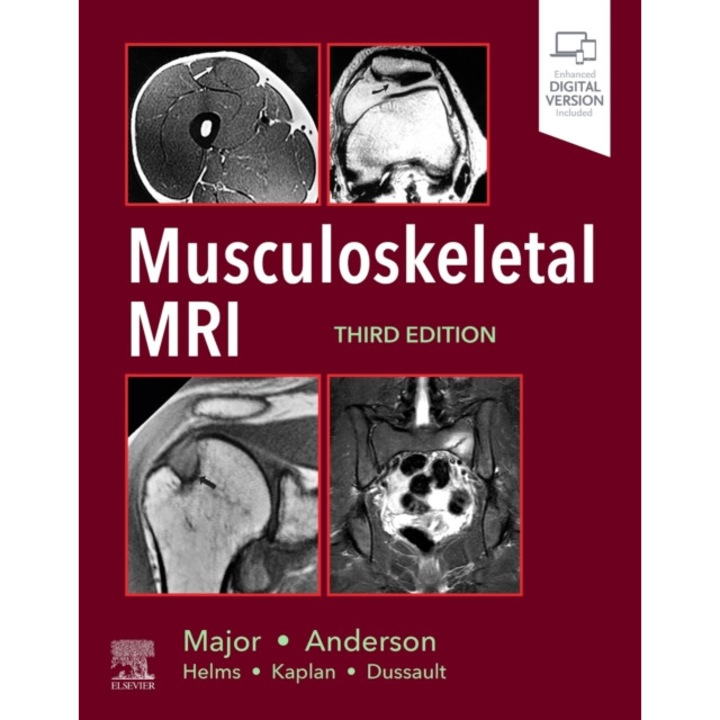 Musculoskeletal MRI de Nancy M. Major