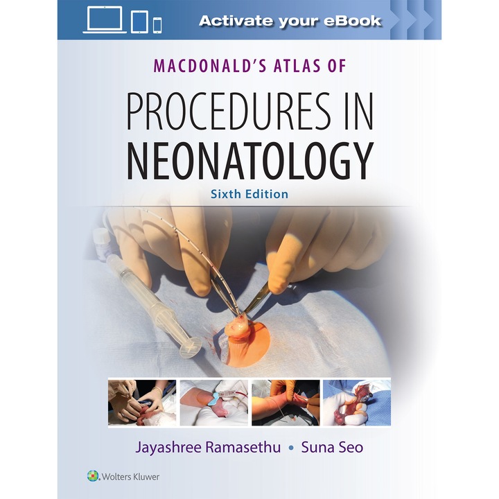 MacDonald's Atlas of Procedures in Neonatology de Jayashree Ramasethu