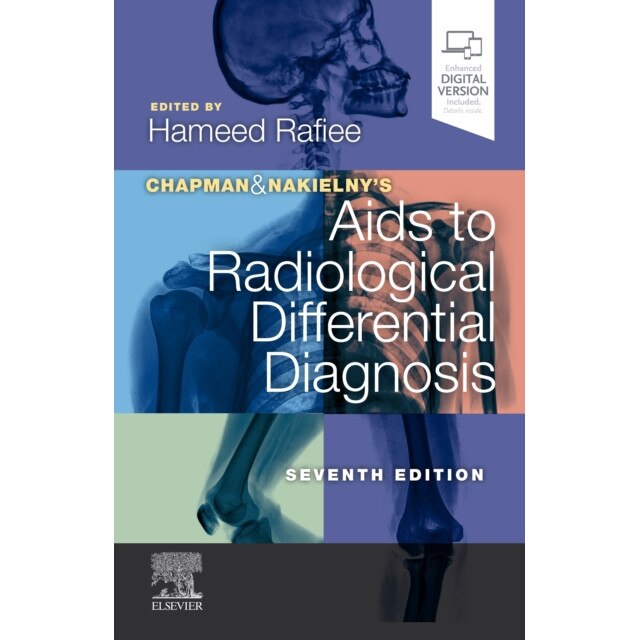 Chapman & Nakielny's Aids to Radiological Differential Diagnosis de Hameed Rafiee