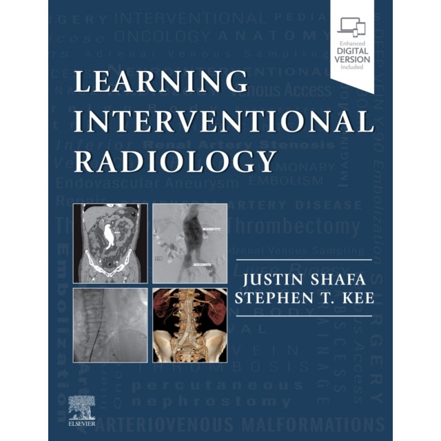 Learning Interventional Radiology de Justin Shafa