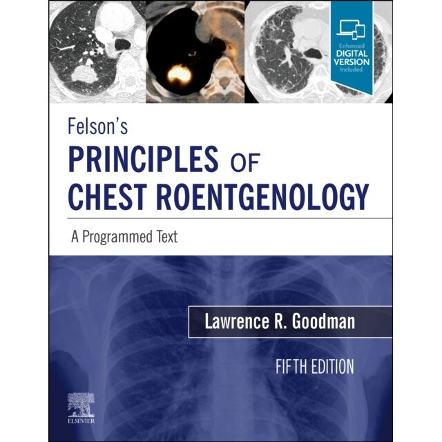 Felson's Principles of Chest Roentgenology, A Programmed Text de Lawrence R. Goodman