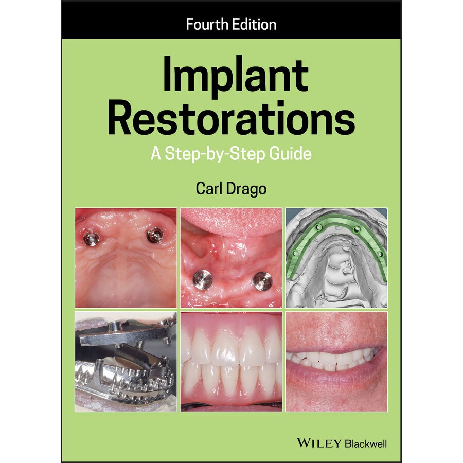 Implant Restorations de Carl Drago