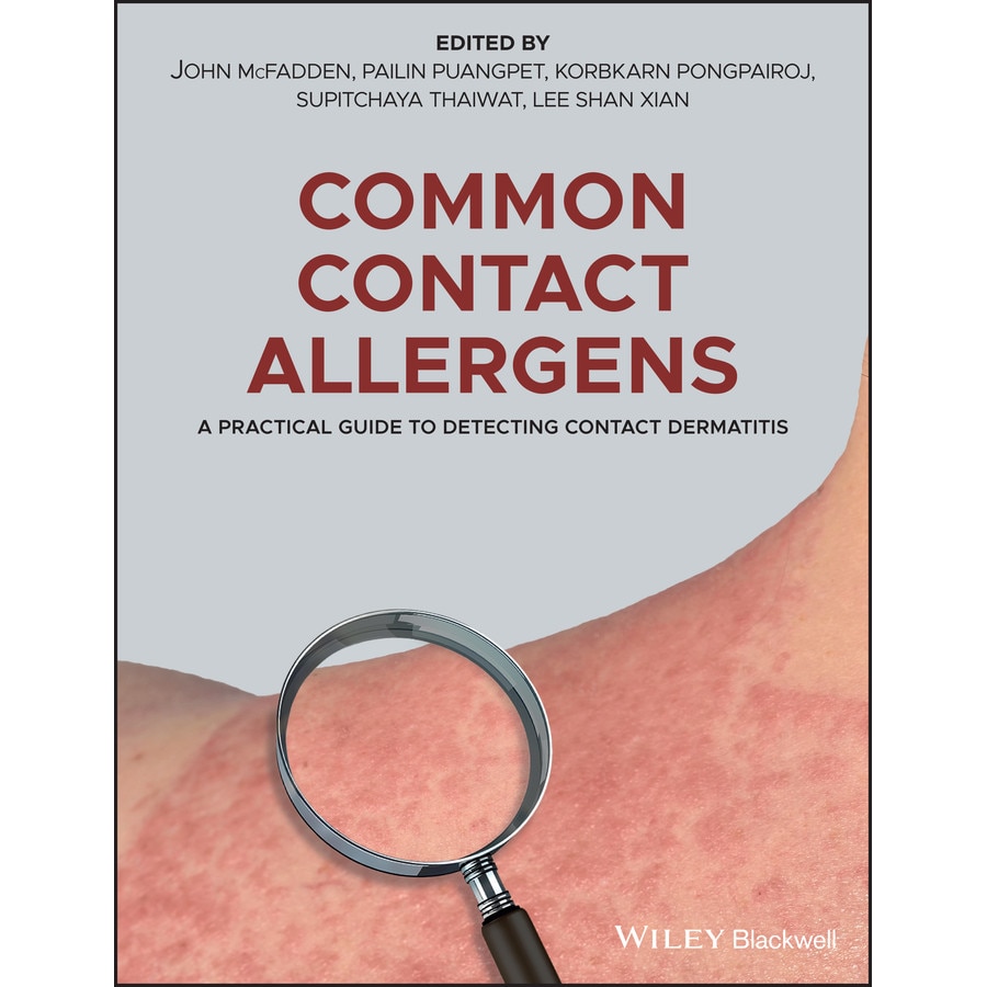 Common Contact Allergens de John McFadden