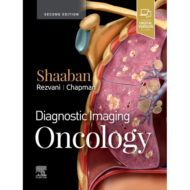 Diagnostic Imaging: Oncology de Akram M. Shaaban