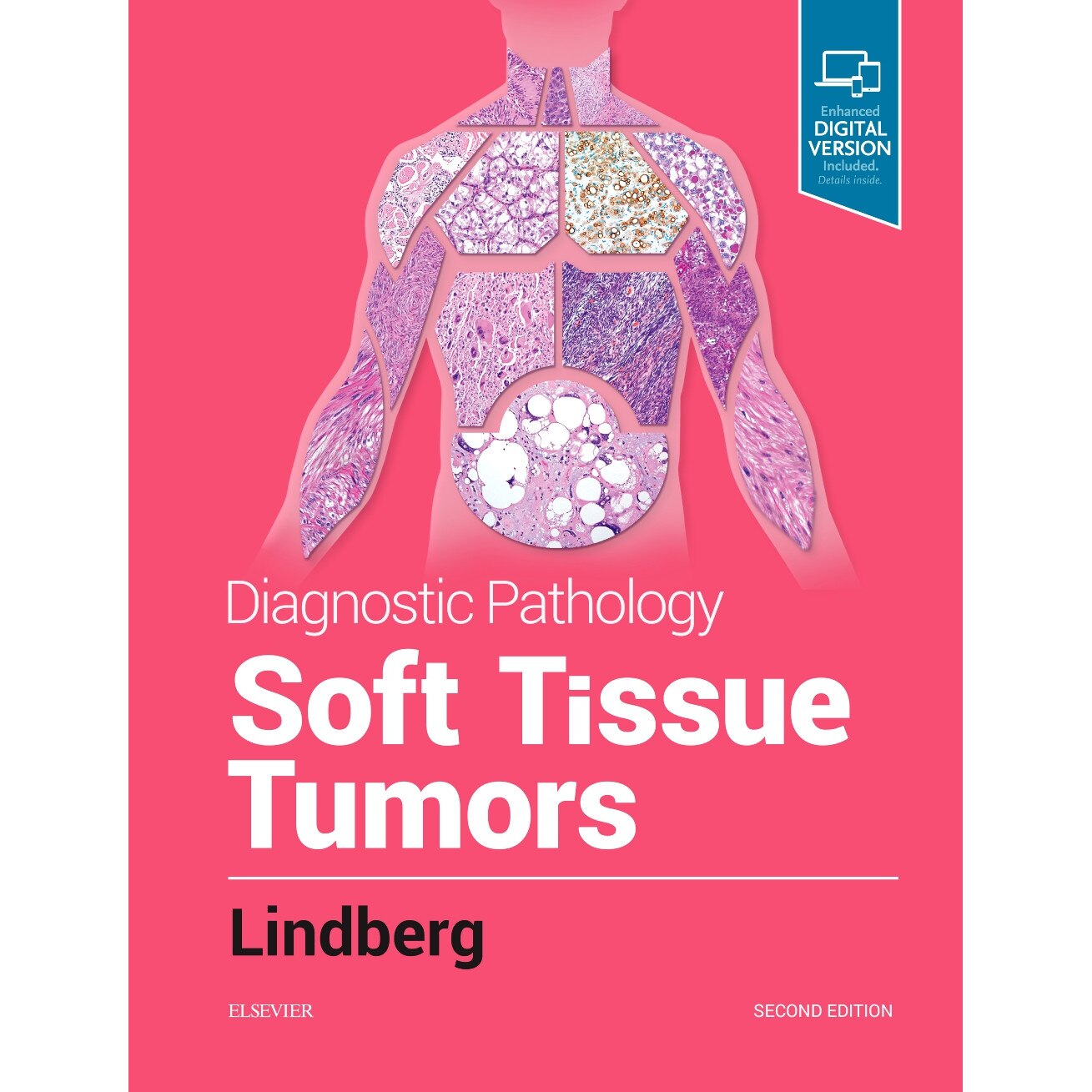 Diagnostic Pathology: Soft Tissue Tumors de Matthew R. Lindberg