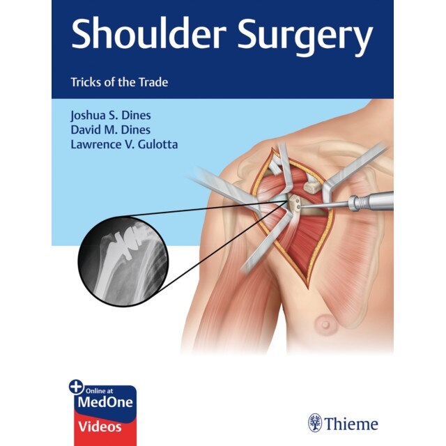 Shoulder Surgery de Joshua Dines