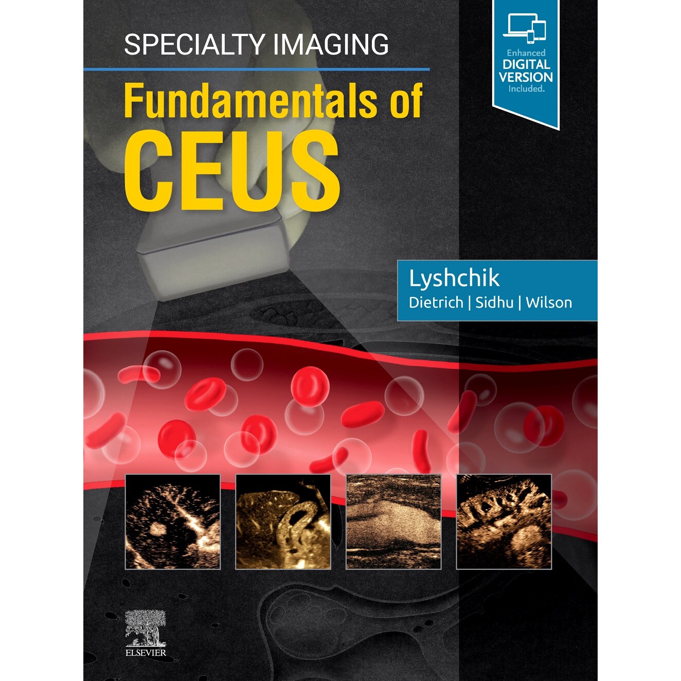 Specialty Imaging: Fundamentals of CEUS de Andrej Lyshchik