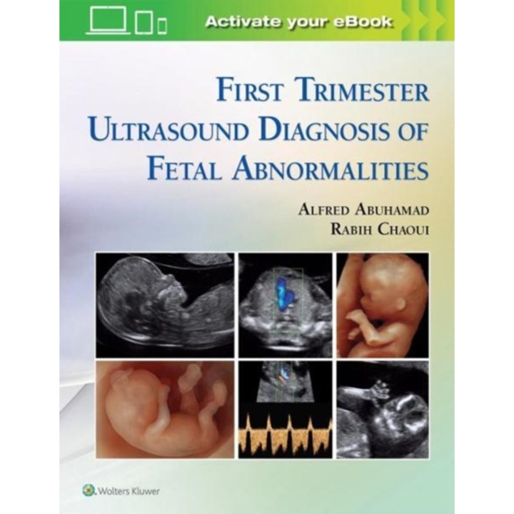 First Trimester Ultrasound Diagnosis of Fetal Abnormalities de Rabih Chaoui