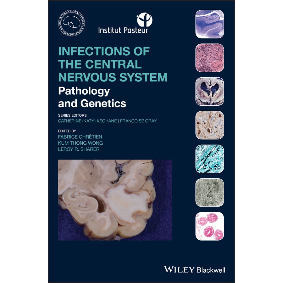 Infections of the Central Nervous System de Fabrice Chretien