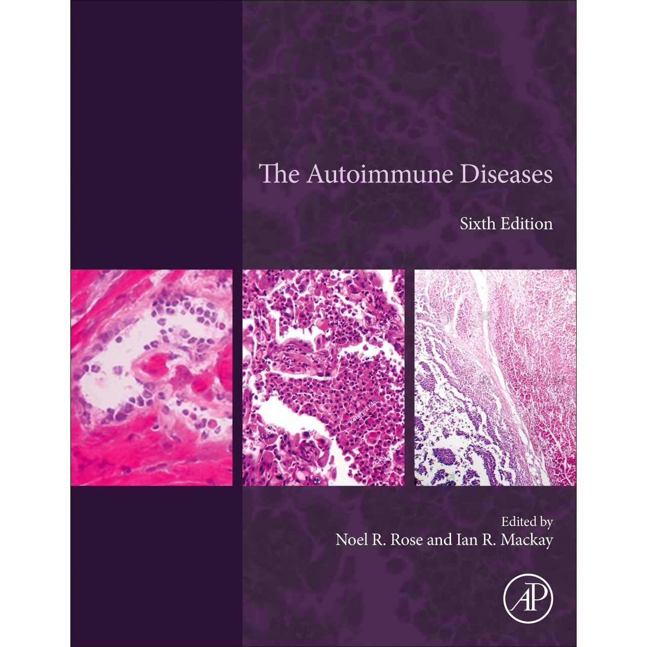 The Autoimmune Diseases de Noel R. Rose