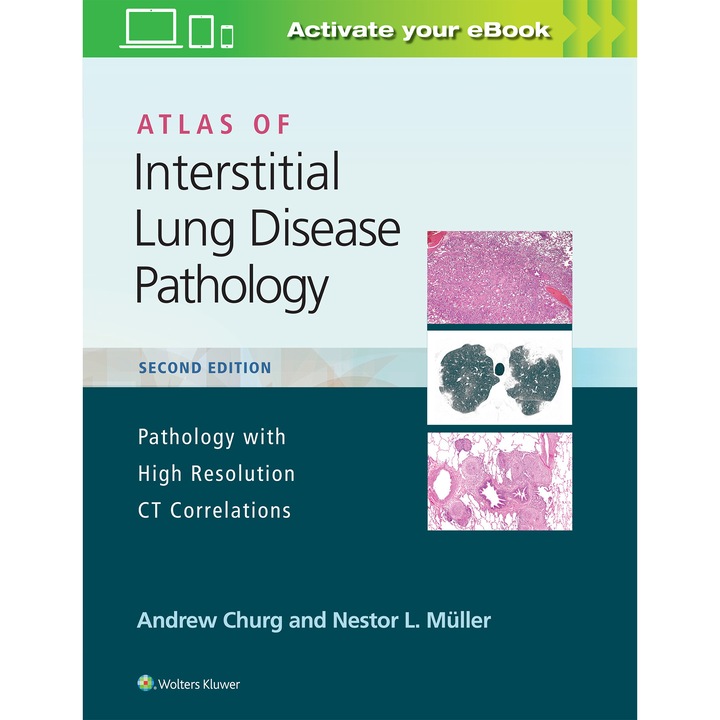 Atlas of Interstitial Lung Disease Pathology de Andrew Churg MD