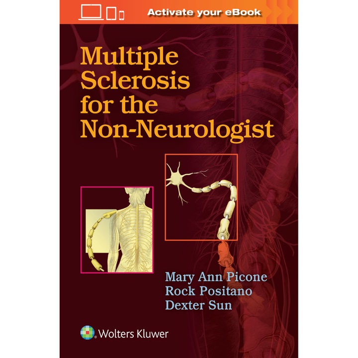 Multiple Sclerosis for the Non-Neurologist de Mary Ann Picone