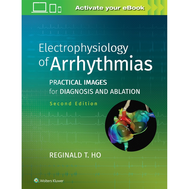 Electrophysiology of Arrhythmias de Reginald T. Ho MD