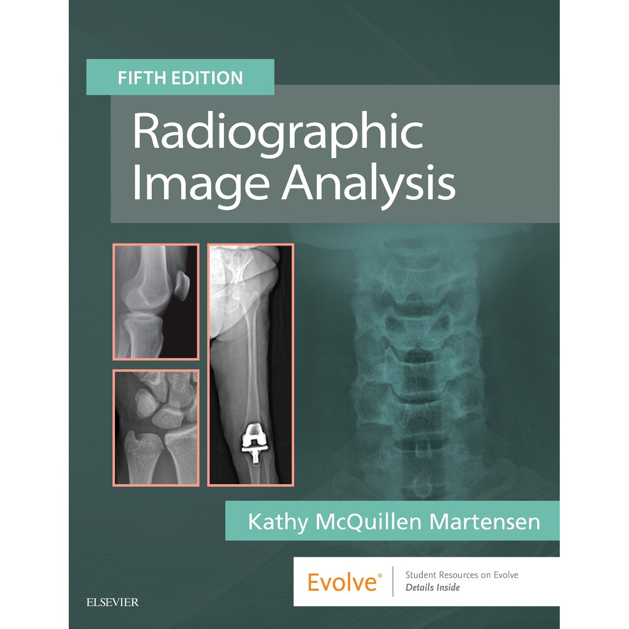 Radiographic Image Analysis de Kathy McQuillen Martensen
