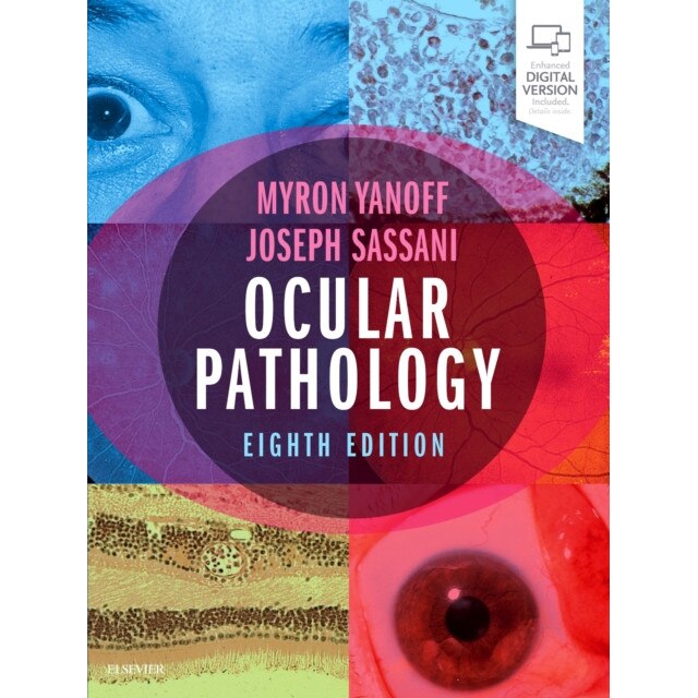 Ocular Pathology de Myron Yanoff