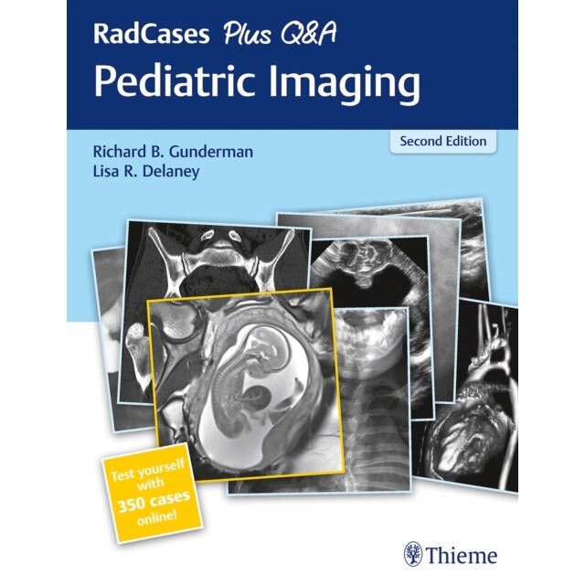 RadCases Plus Q&A Pediatric Imaging de Richard B. Gunderman