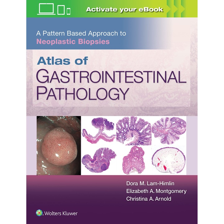 Atlas of Gastrointestinal Pathology: A Pattern Based Approach to Neoplastic Biopsies de Christina Arnold M.D.