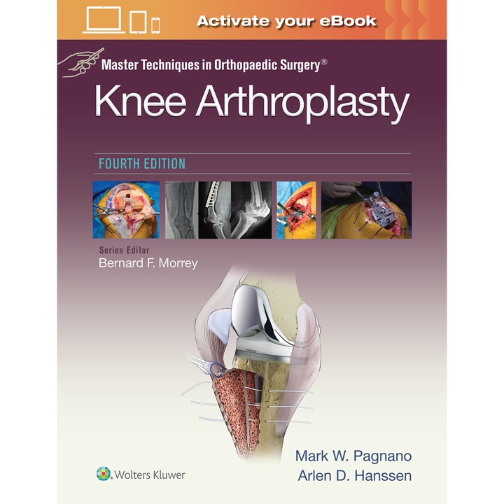 Master Techniques in Orthopedic Surgery: Knee Arthroplasty de Mark W. Pagnano MD