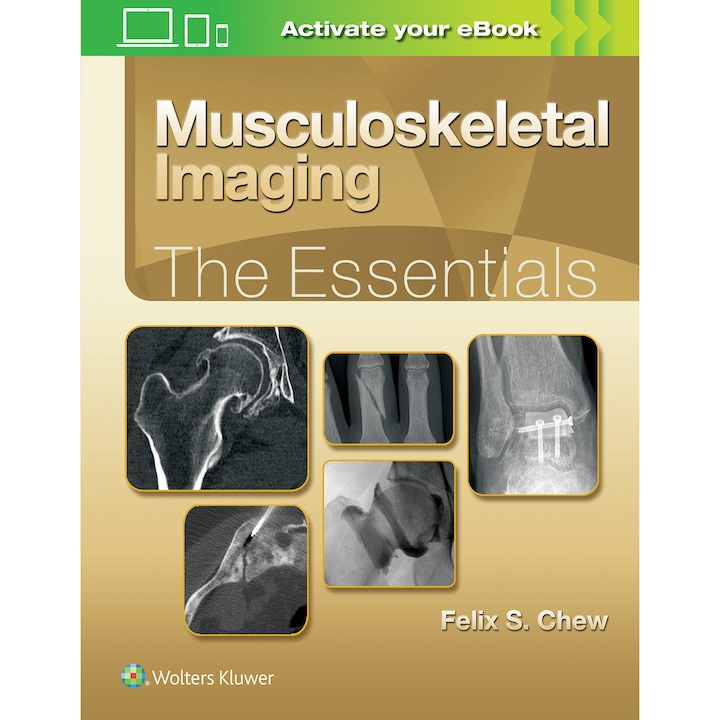 Musculoskeletal Imaging: The Essentials de Felix S. Chew MD