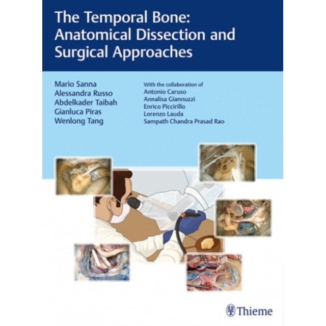 The Temporal Bone de Mario Sanna