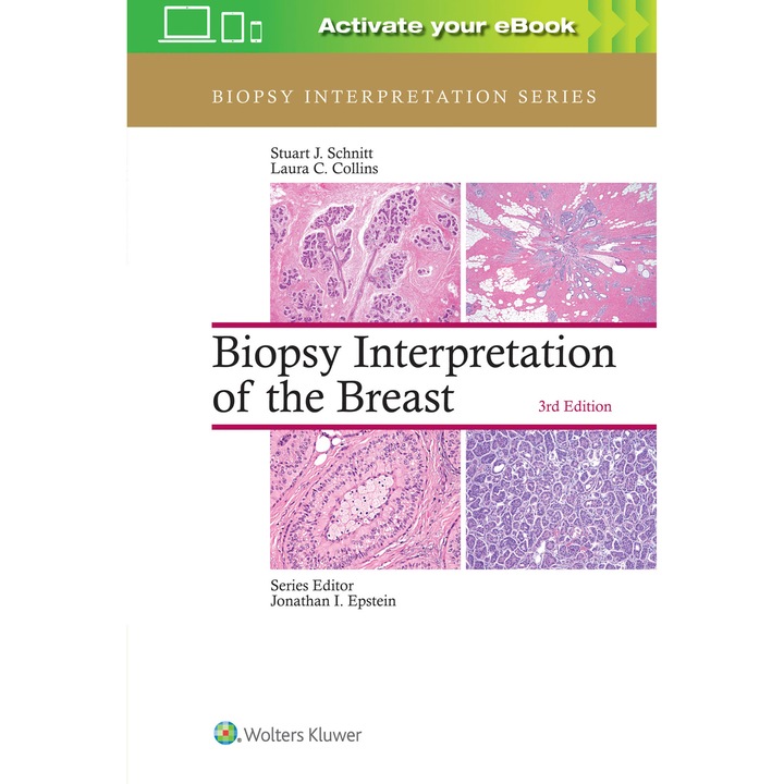 Biopsy Interpretation of the Breast de Stuart J. Schnitt MD
