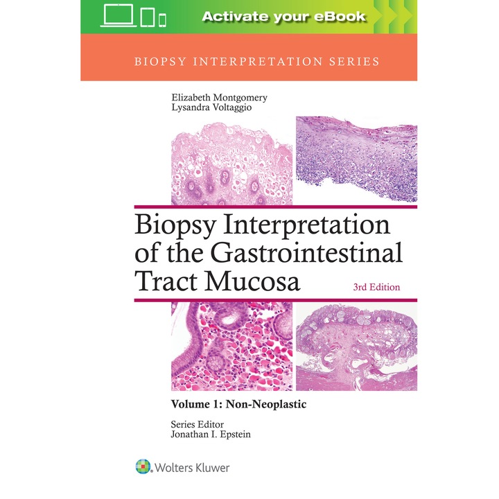 Biopsy Interpretation of the Gastrointestinal Tract Mucosa: Volume 1: Non-Neoplastic de Elizabeth A. Montgomery MD