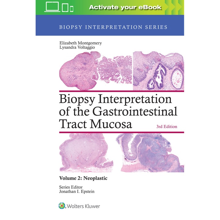 Biopsy Interpretation of the Gastrointestinal Tract Mucosa: Volume 2: Neoplastic de Elizabeth A. Montgomery MD
