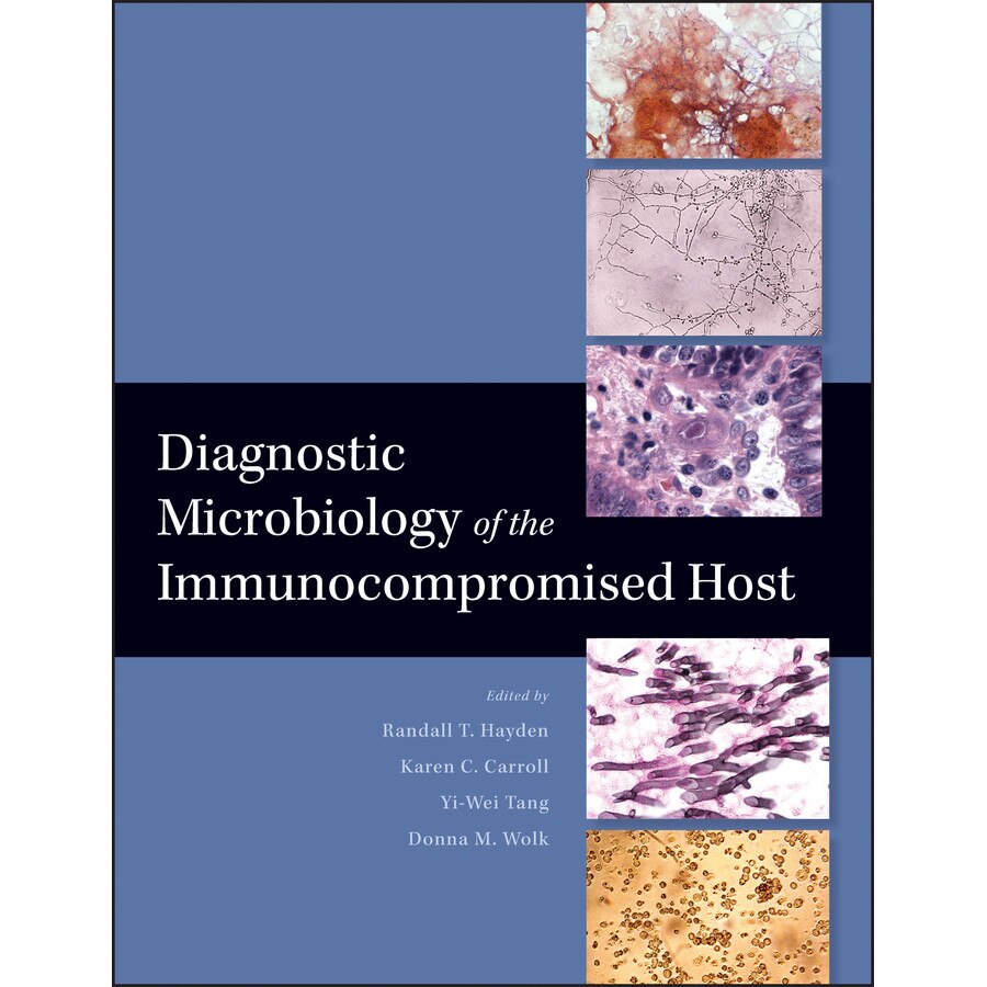 Diagnostic Microbiology of the Immunocompromised Host de Randall T. Hayden