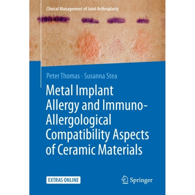 Metal Implant Allergy and Immuno-Allergological Compatibility Aspects of Ceramic Materials de Peter Thomas