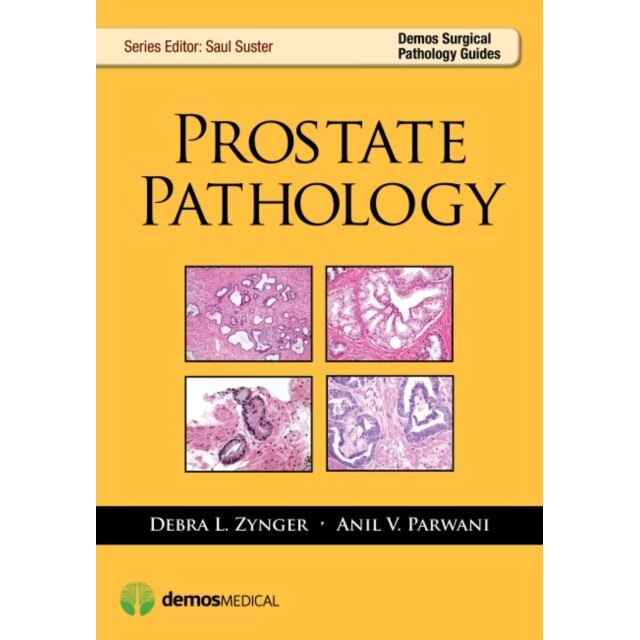 Prostate Pathology de Debra L. Zynger