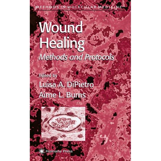 Wound Healing de Luisa A. DiPietro
