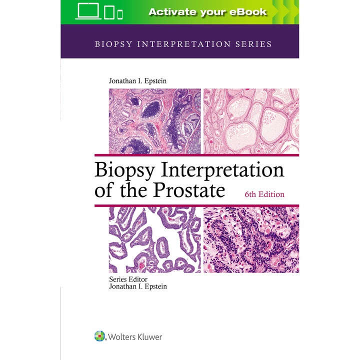Biopsy Interpretation of the Prostate de Jonathan I. Epstein