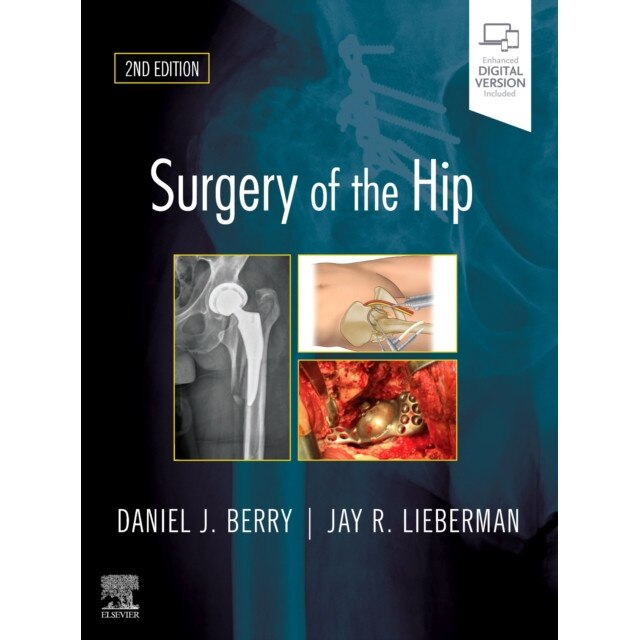Surgery of the Hip de Daniel J. Berry [Hardback]