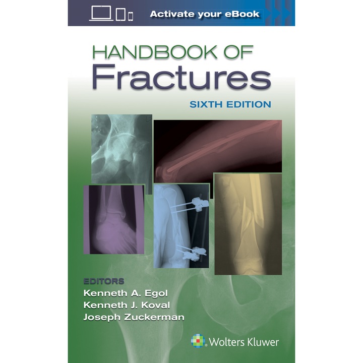 Handbook of Fractures de Kenneth Egol MD