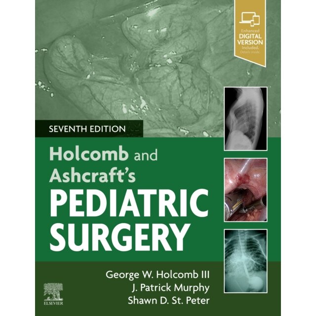 Ashcraft's Pediatric Surgery de George W. Holcomb [Hardback]