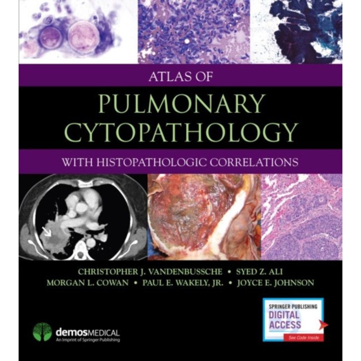Atlas of Pulmonary Cytopathology de Ali