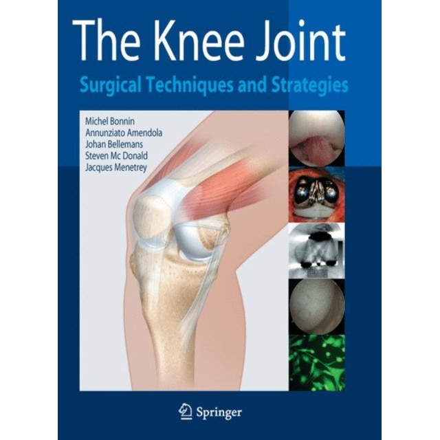 The Knee Joint de Michel Bonnin